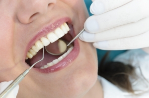 How Do You Prevent Gum Disease? How Do You Prevent Gum Disease?